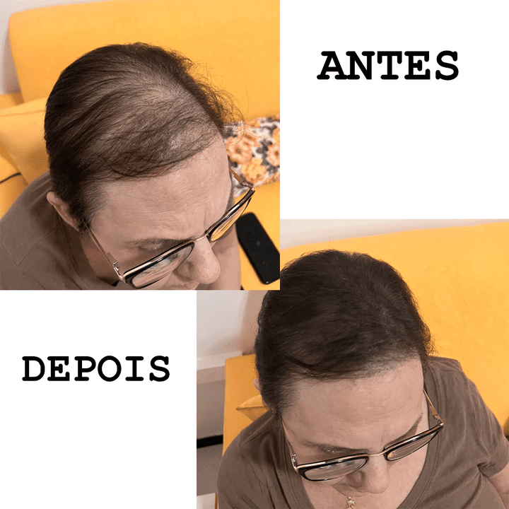 Pó Maquiagem p/ Cabelo à Prova D'água, diga Adeus às Falhas Unissex - SEVÍCH ✅